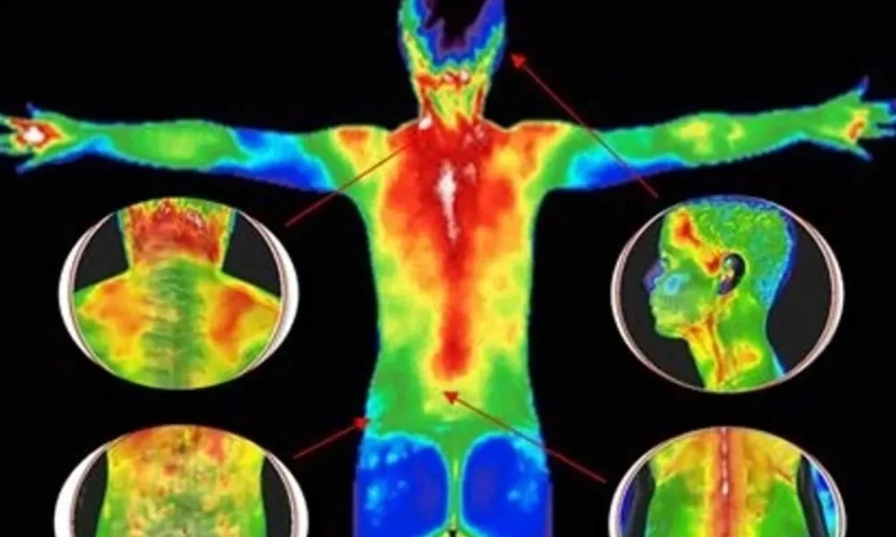 Termografia-Exame-o-que-e